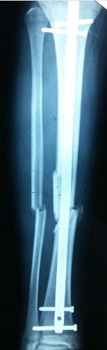 X-ray