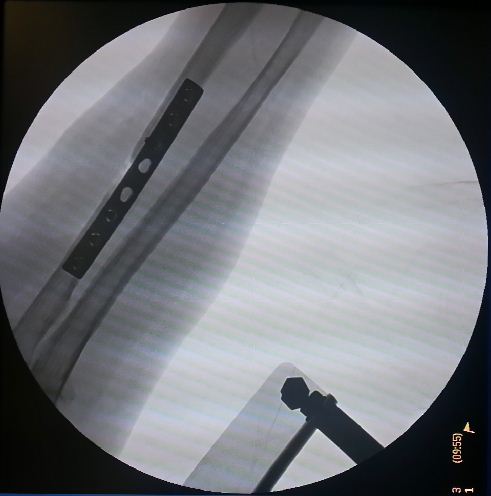 X-ray