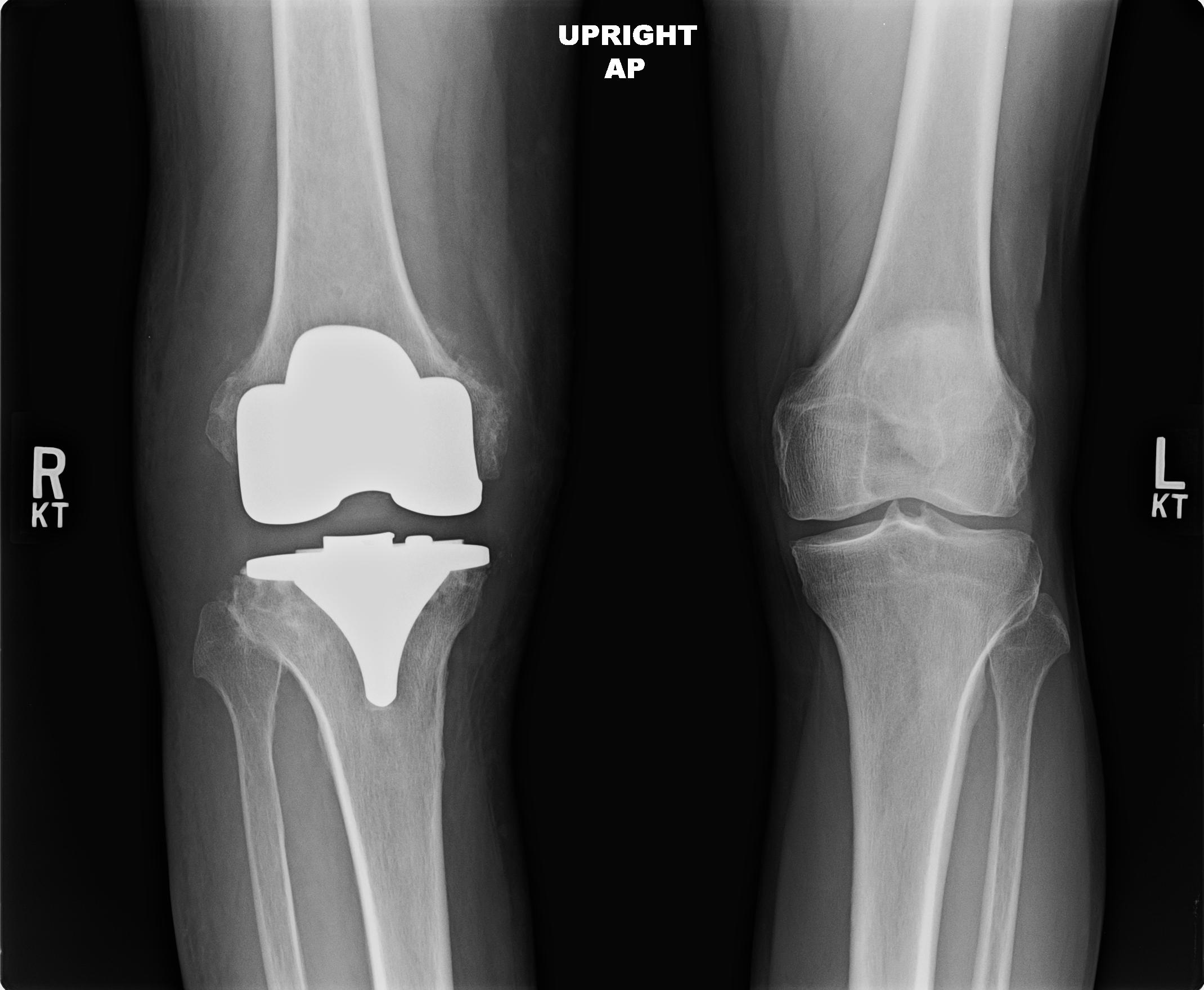 X-ray