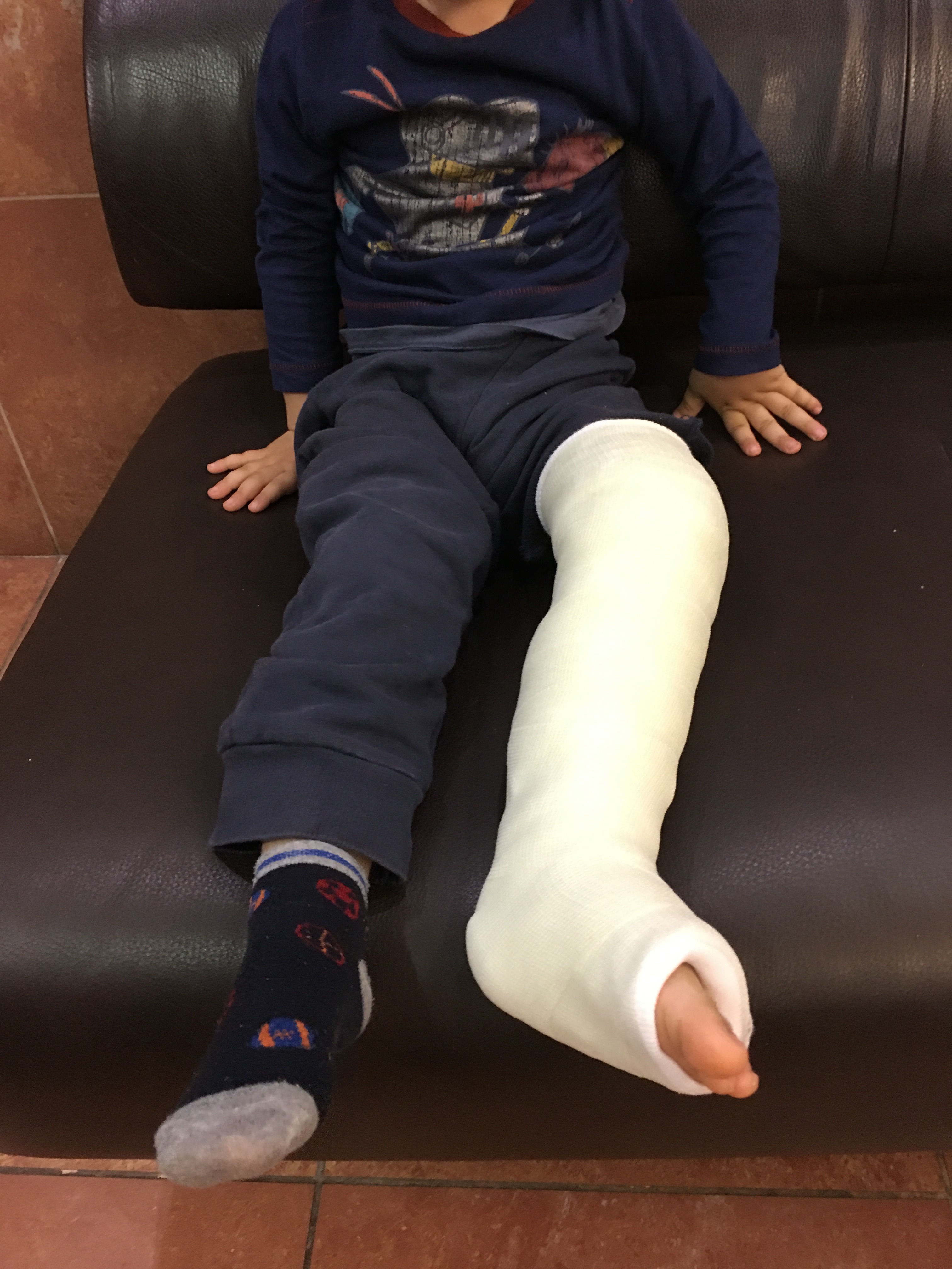 Kid with a casted leg