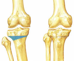 X-ray
